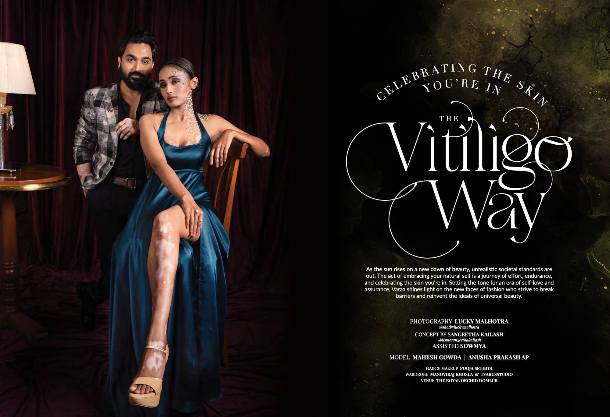 https://luckymalhotra.com/vitiligo-concept-shoot-for-varaa-magazine/